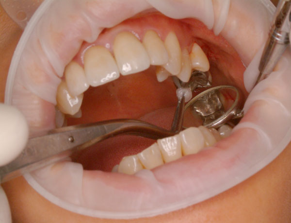 images/dentysta6.jpg1b8af.jpg